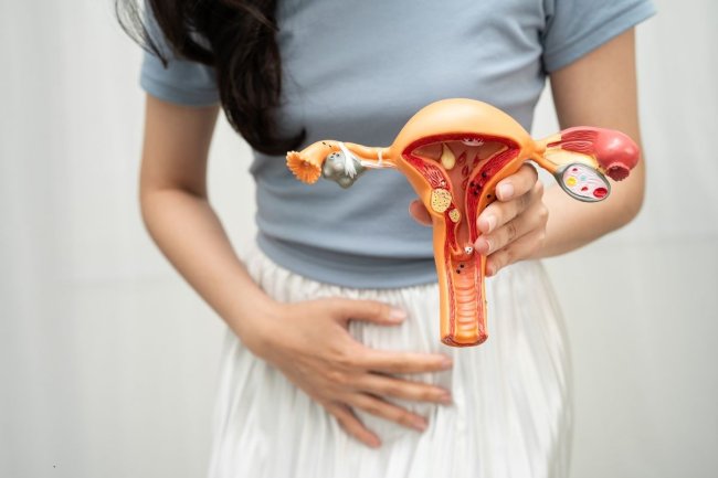 como-tratar-teratoma-ovario