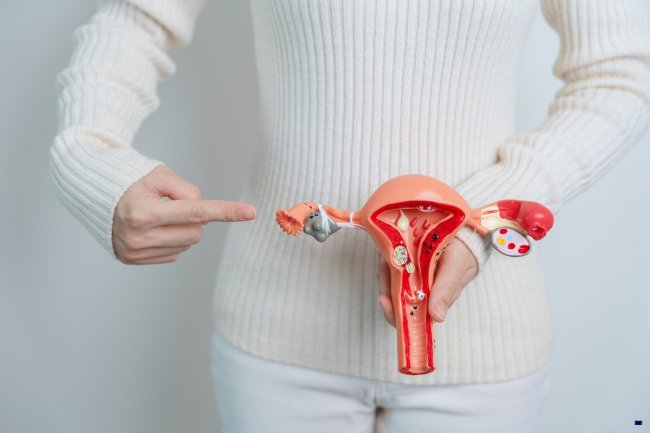 mioma-uterino